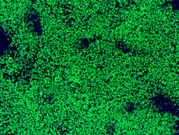 Human Pluripotent Stem Cell-derived Neural Crest Cells