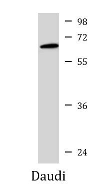 Anti-YY1, clone 1183CT6.5.23.6