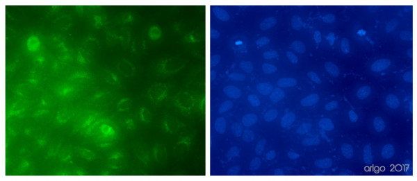 Anti-Transferrin Receptor / CD71, clone DF1513