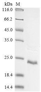 Solute carrier organic anion transporter family member 2B1 (SLCO2B1), partial, human, recombinant