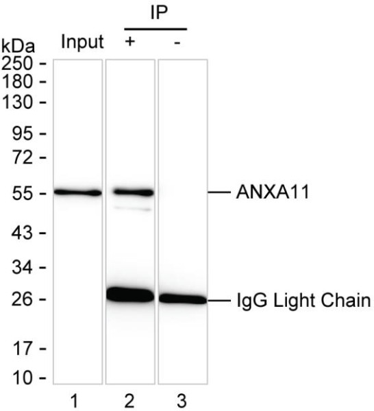 Anti-ANXA11
