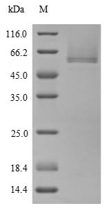 Cartilage intermediate layer protein 1 (CILP), partial, human, recombinant