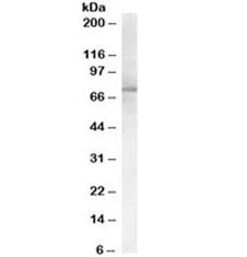 Anti-PCSK9