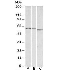 Anti-ADRA1B