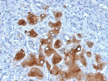 Anti-Serum Amyloid A / SAA1 + SAA2, clone SAA/326