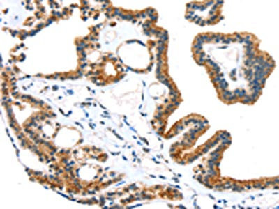 Anti-TRPM6