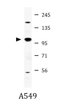 Anti-EPAS1 / HIF-2 alpha