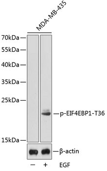Anti-phospho-EIF4EBP1-T36