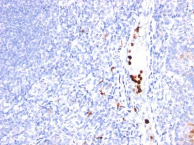 Anti-Granulocyte-Colony Stimulating Factor (G-CSF)(Clone: SPM468)