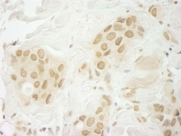 Anti-MKRN1 (IHC)