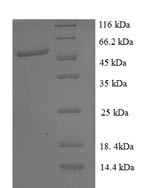 PRKCA-binding protein (PICK1), partial, human, recombinant