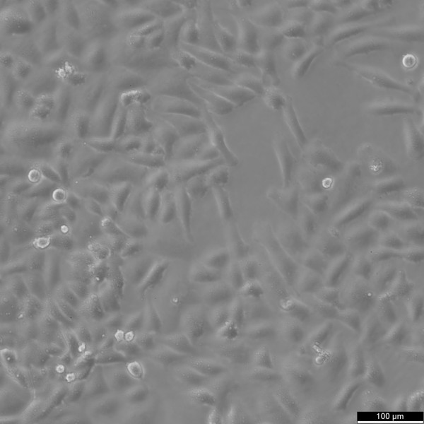 SK-LU-1 Cells
