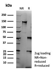 Anti-CD95 / FAS / TNFRSF6, recombinant antibody, clone FAS/9322R