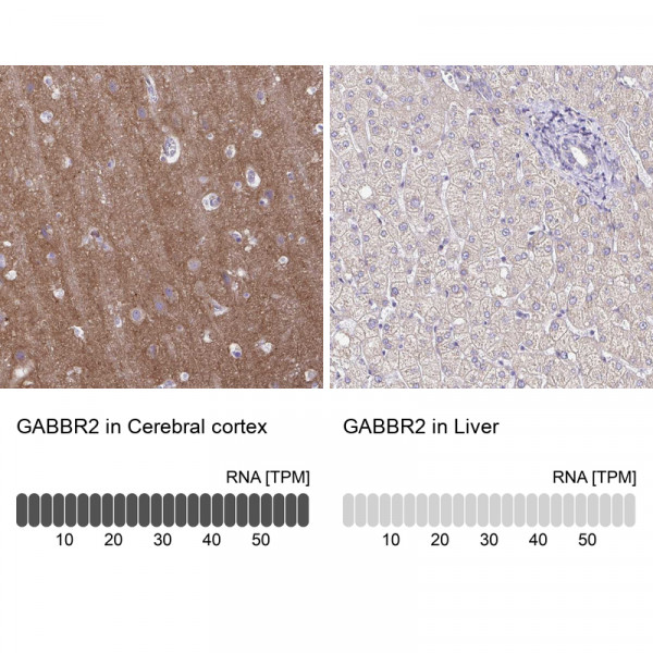 Anti-GABBR2
