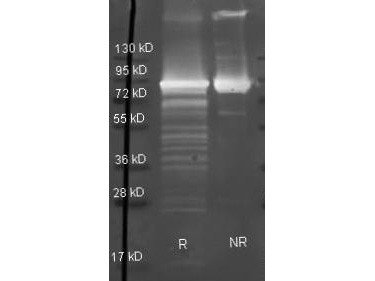 Anti-Maltose Phosphorylase (E.Coli)