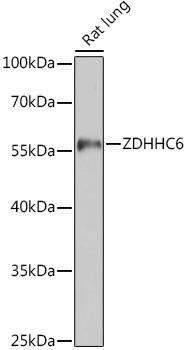 Anti-ZDHHC6
