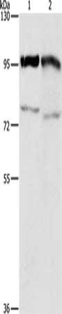 Anti-EZH2