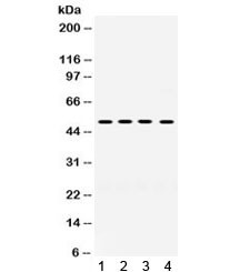 Anti-KIM-1 / TIM-1 / HAVCR1