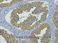 Anti-CK-19, clone 5F1