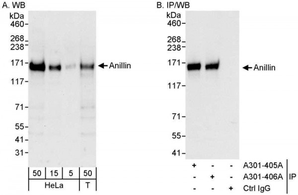 Anti-Anillin