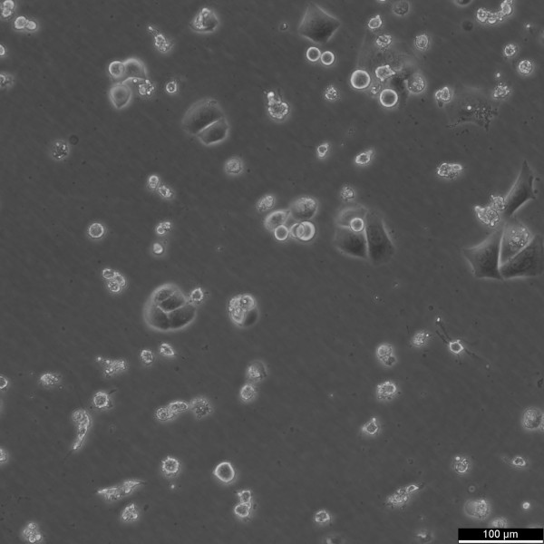 KPL-4 Cells
