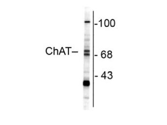 Anti-ChAT (Choline Acetyltransferase)