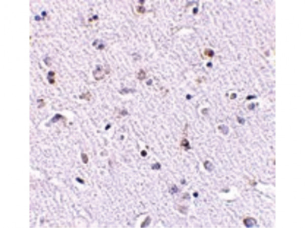 Anti-Nanos1