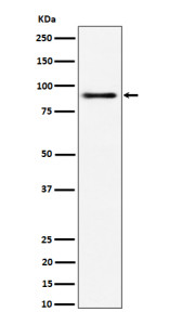 Anti-ACAP2 / ArfGAP with coiled-coil ankyrin repeat and PH domains 2, clone 30A18