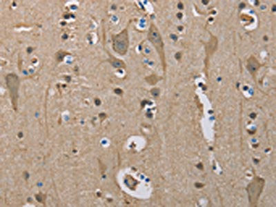 Anti-SERPINA1