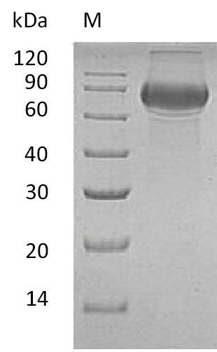 B-lymphocyte antigen CD19 (CD19), partial (Active), human, recombinant