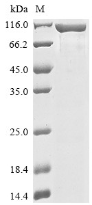 Hepatitis A virus cellular receptor 1 (HAVCR1), partial, human, recombinant
