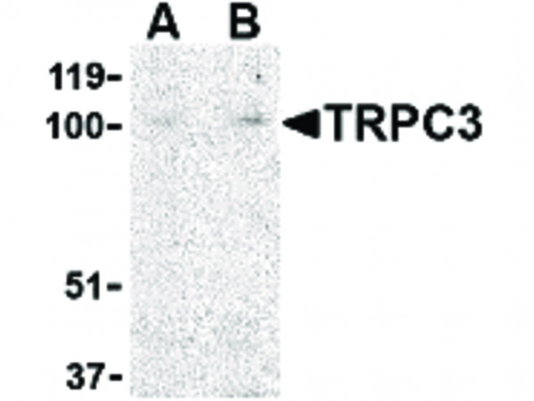 Anti-TRPC3