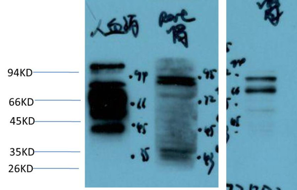 Anti-Kininogen 1