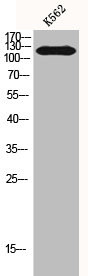 Anti-HDAC5