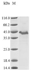 A disintegrin and metalloproteinase with thrombospondin motifs 9 (ADAMTS9), partial, human, recombin