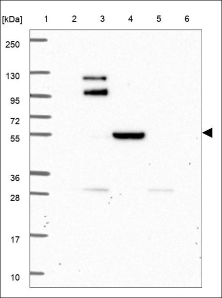 Anti-MMP27