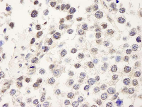Anti-CDC25c (IHC)