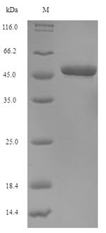 N-glycosylase/DNA lyase (OGG1), human, recombinant
