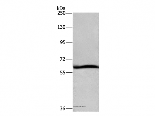 Anti-DCP1A