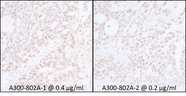 Anti-SUPT6H