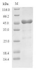 60S acidic ribosomal protein P0 (RPLP0), human, recombinant