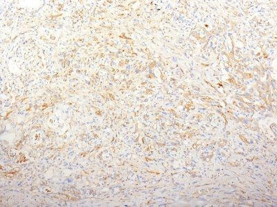 Anti-Fibronectin(TV-1), CF405S conjugate, 0.1mg/mL