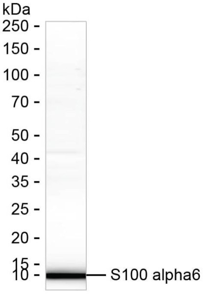 Anti-S100 alpha6