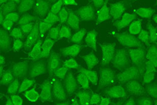 Anti-TRH / Thyrotropin Releasing Hormone