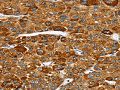 Anti-SPARCL1