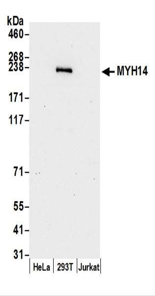 Anti-MYH14/Myosin-14