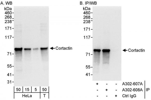 Anti-Cortactin