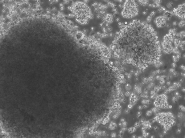 B-LCL-HROC32 (Bc HROC32) Cells