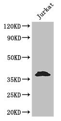 Anti-MCL1