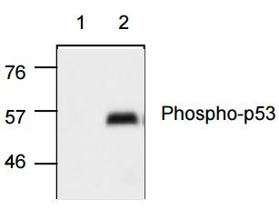 Anti-phospho-p53 (Ser15)